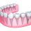 The Long-Term Effect of Missing Teeth and How Cosmetic Dental Implants in Winston-Salem, NC Can Help You!