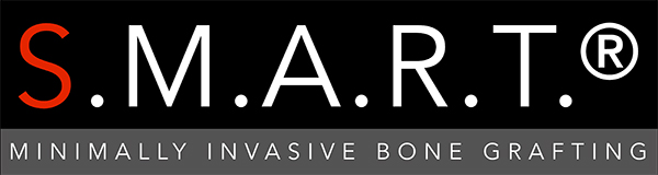 S.M.A.R.T.™ Logo